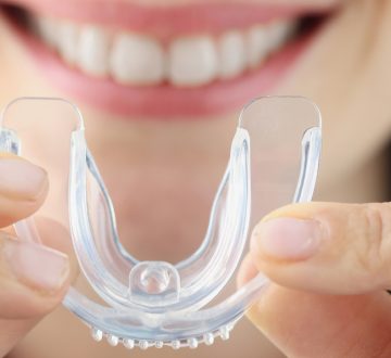 Protecting Your Teeth and Mouth with Mouthguards