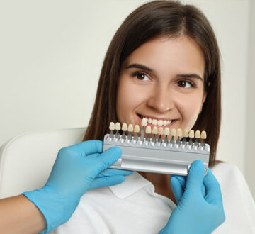How Do Dental Veneers Compare to Other Cosmetic Dental Treatments?